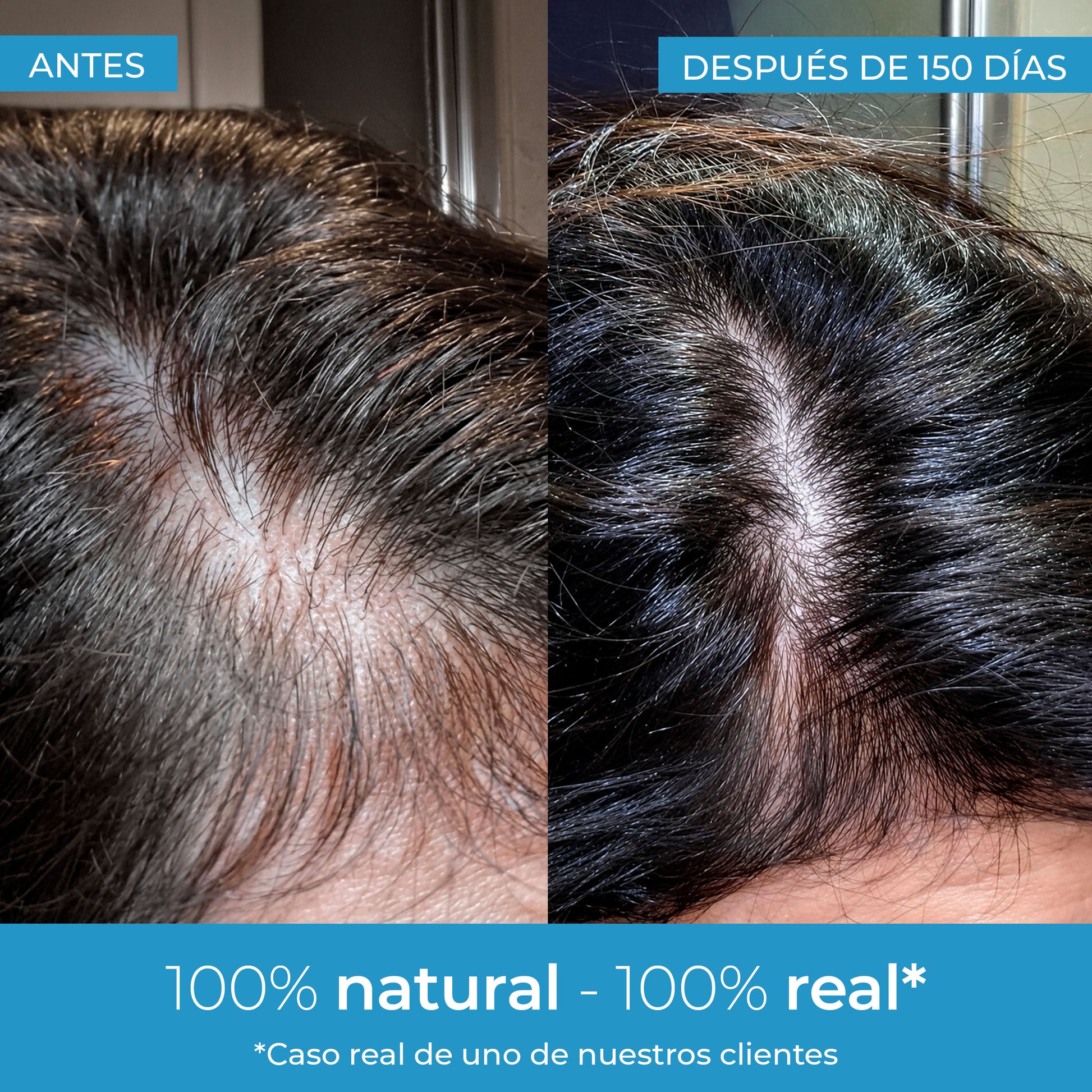 Strength Lozione per la crescita dei capelli Arganour 50 ml