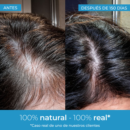 Strength Lozione per la crescita dei capelli Arganour 50 ml