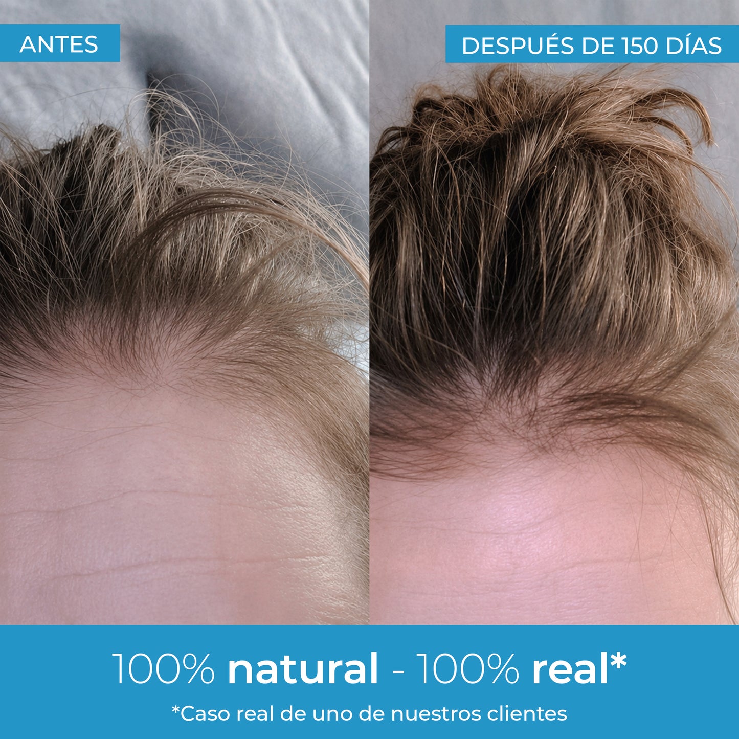 Strength Lozione per la crescita dei capelli Arganour 50 ml