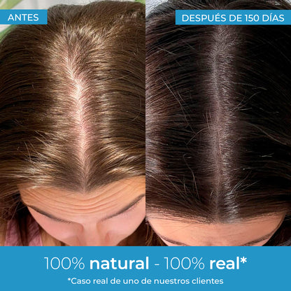 Strength Lozione per la crescita dei capelli Arganour 50 ml